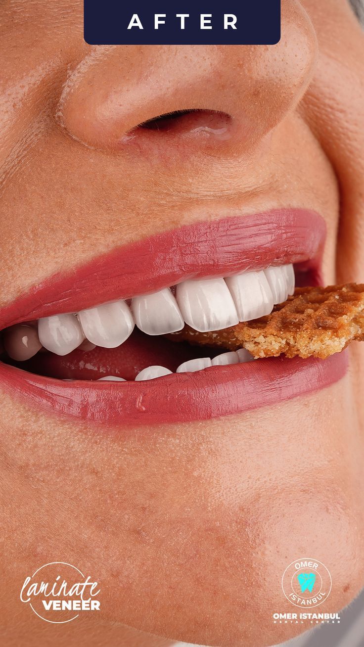 Guaranteed Durability