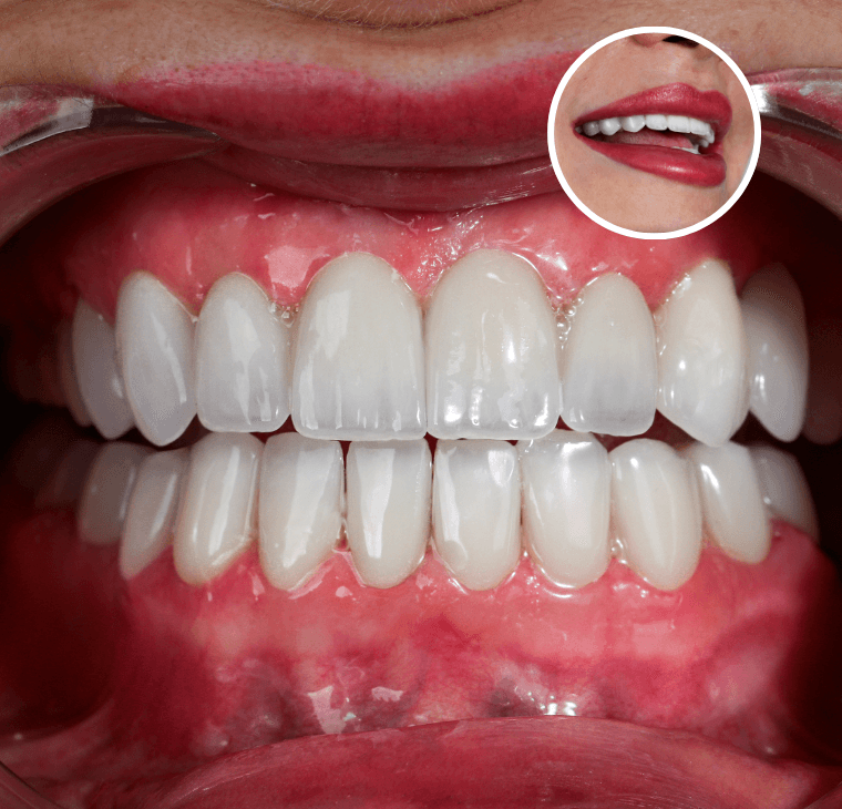 Untitled design (34).png